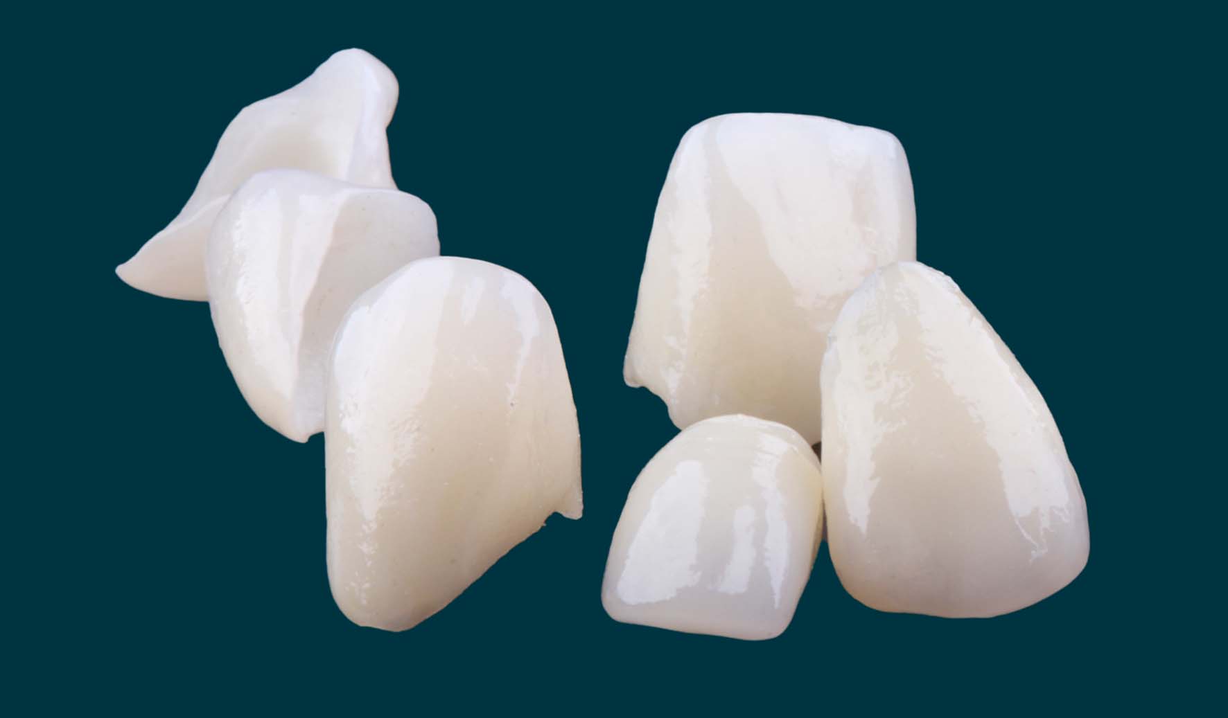 facetas de porcelana
